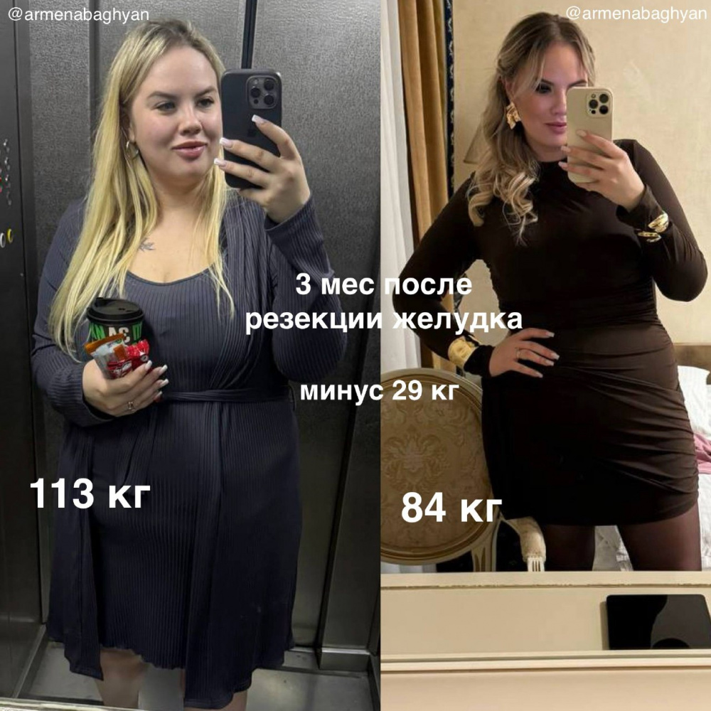 Что изменится после операции?